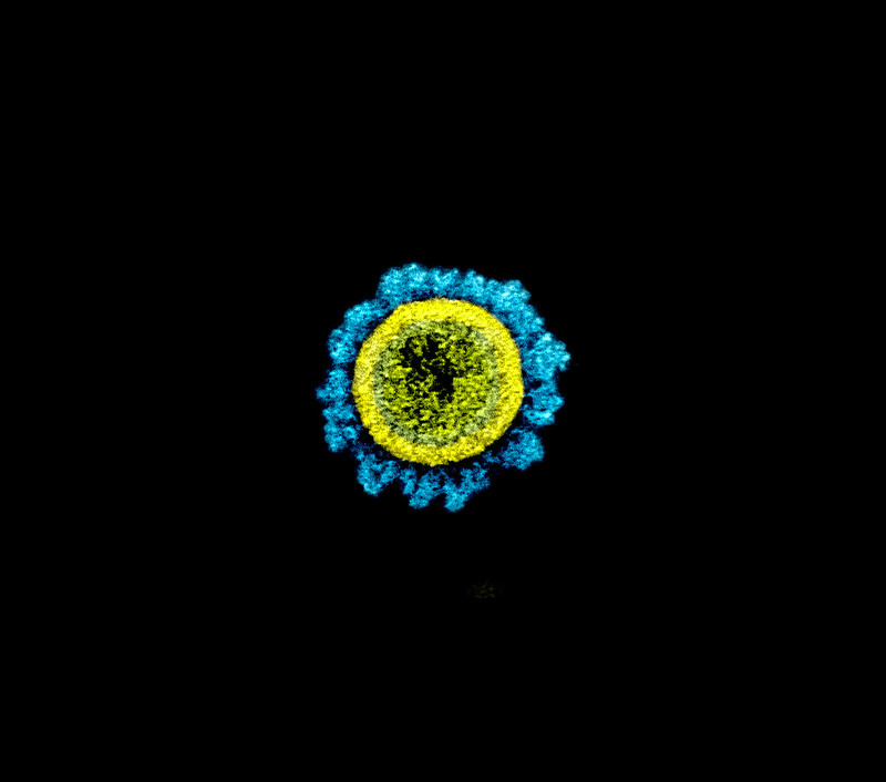 false color electron micrograph of a SARS-CoV-2 virus particle, looking like a ball with spikes